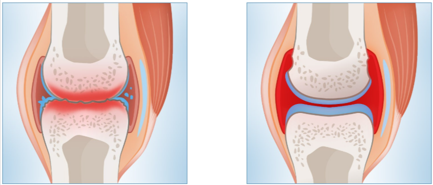 Joint N-11 Benefits