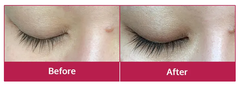 Miracle Lash Benefit