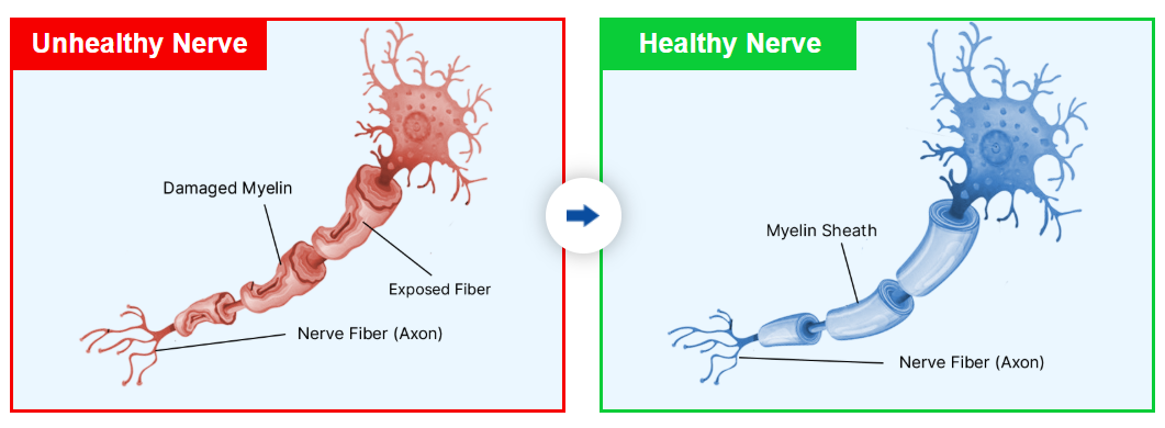 Advanced Nerve Support nerve health