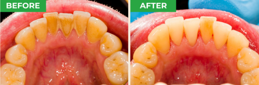 ProXental customer Reviews 2
